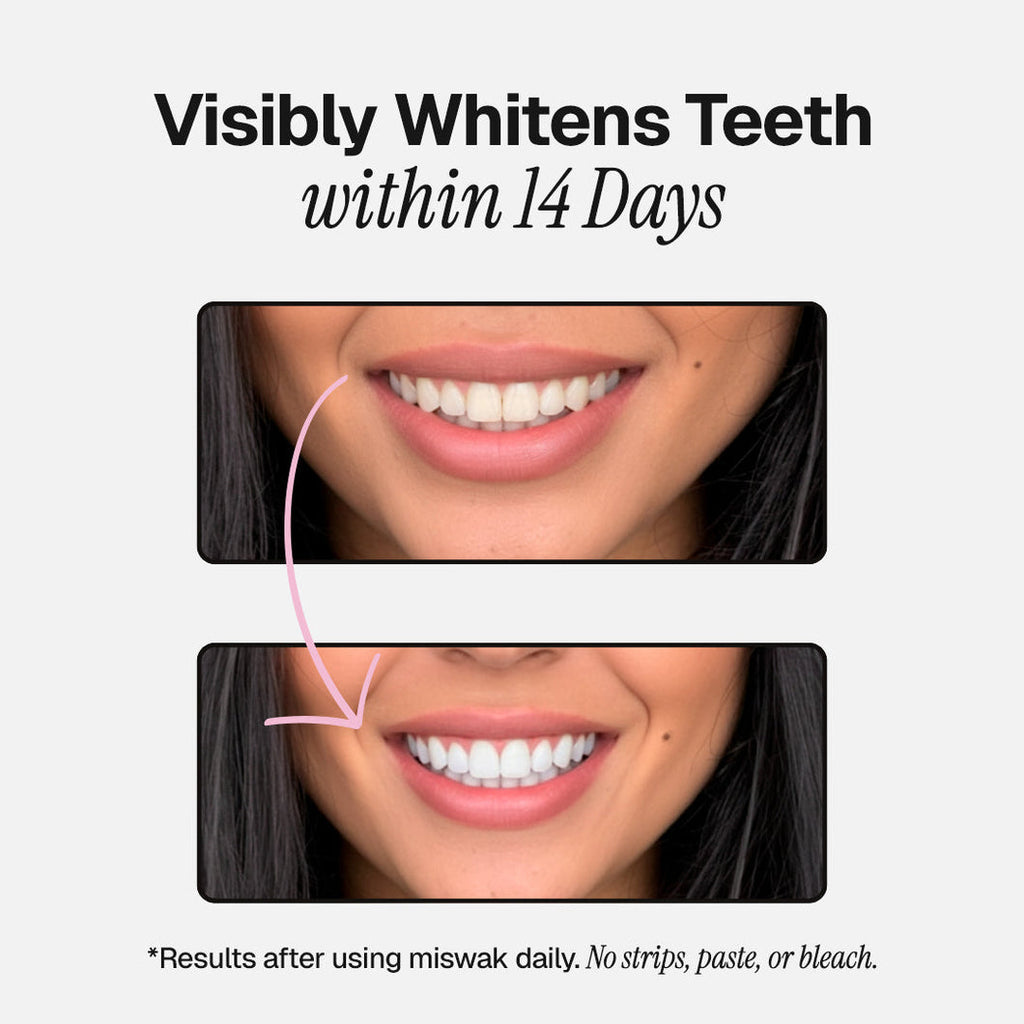 Miswak | Nature’s Original Toothbrush